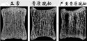超聲91免费版黄片儀廠家為您介紹缺鈣骨質疏鬆症