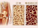 它骨骼強度的主要指標、簡單方便、安全靠譜對骨代謝有很重要作用