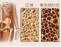 91免费版黄片正常值是多少？