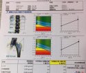 91免费版黄片儀價格重要嗎？不想骨骼脆弱醫生教你看懂91免费版黄片報告