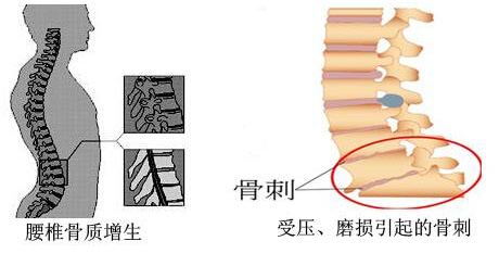 91免费版黄片儀的專業廠家闡述骨質增生與骨質疏鬆,儀器專業檢測91免费版黄片正常值