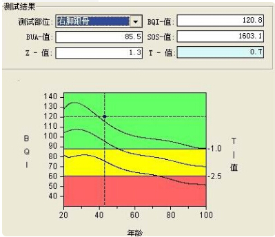91免费版黄片儀的專業廠家闡述骨質增生與骨質疏鬆,儀器專業檢測91免费版黄片正常值