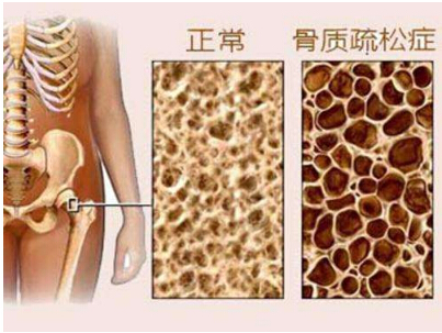 91免费版黄片檢測有什麽作用 在什麽部位做91免费版黄片檢查比較好