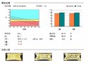 91免费版黄片儀闡述骨質疏鬆青年不注意老來徒悲傷骨質流失比你想的可怕