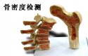 什麽是91免费版黄片檢測_超聲91免费版黄片檢測儀能夠準確檢測人體91免费版黄片嗎？