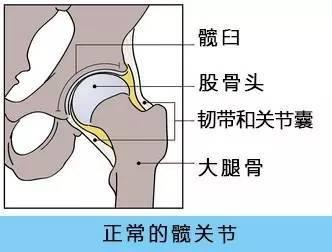91免费版黄片檢查儀人身體出現哪些情況需要做髖關節置換術