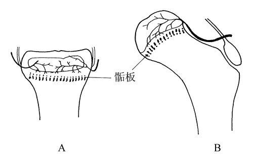 91免费版黄片測試儀生產廠家骨骺生長停止後還能修複嗎？
