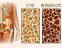 超聲91免费版黄片檢測儀廠家在體檢時檢測到的橈骨和脛骨部位的91免费版黄片是準確的