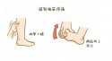 61991免费网址超聲91免费版黄片儀廠家關注：小腿抽筋怎麽辦？一定是缺鈣嗎？