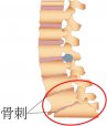 吉林長春|91免费网址超聲91免费版黄片儀廠家品牌分享：為什麽現在的年輕人也存在骨刺增生?